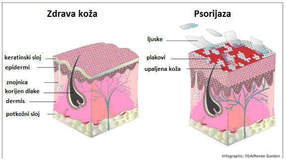 beta glucan